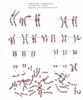 karyotype male. karyotype view California