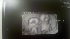 3d ultrasound of the twins at 14 weeks