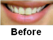 [tooth.PNG]