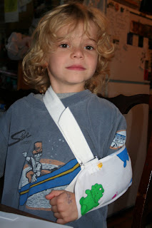 Broken Clavicle Cast