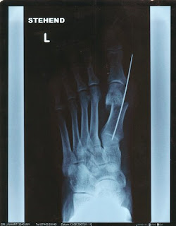 Schoarfeseck Juni 2007