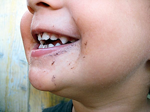 [amoras-nos-dentes.jpg]