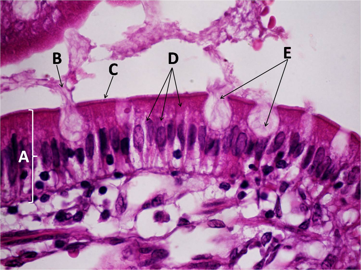 las células caliciformes