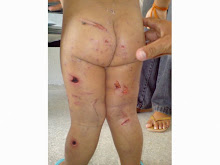 CHEGA!!! CLIC NA IMAGEM