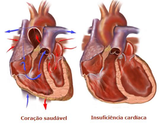 INSUFICIENCIA AND CARDIACA insuficiencia and cardiaca: