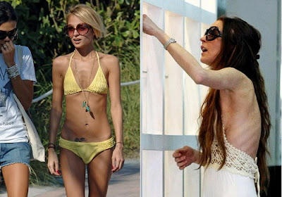 таблетки для похудения инновационные eco slim таблетки для похудения инновационные eco slim