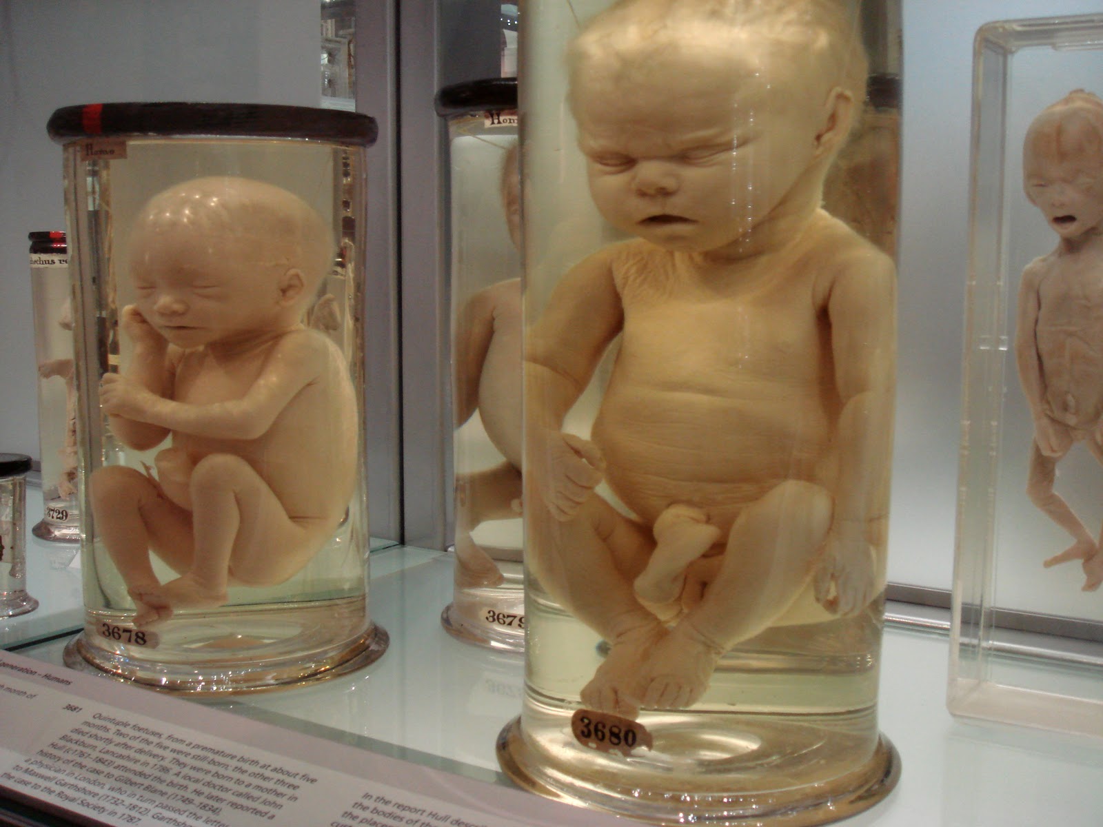 Charles Byrne Skeleton