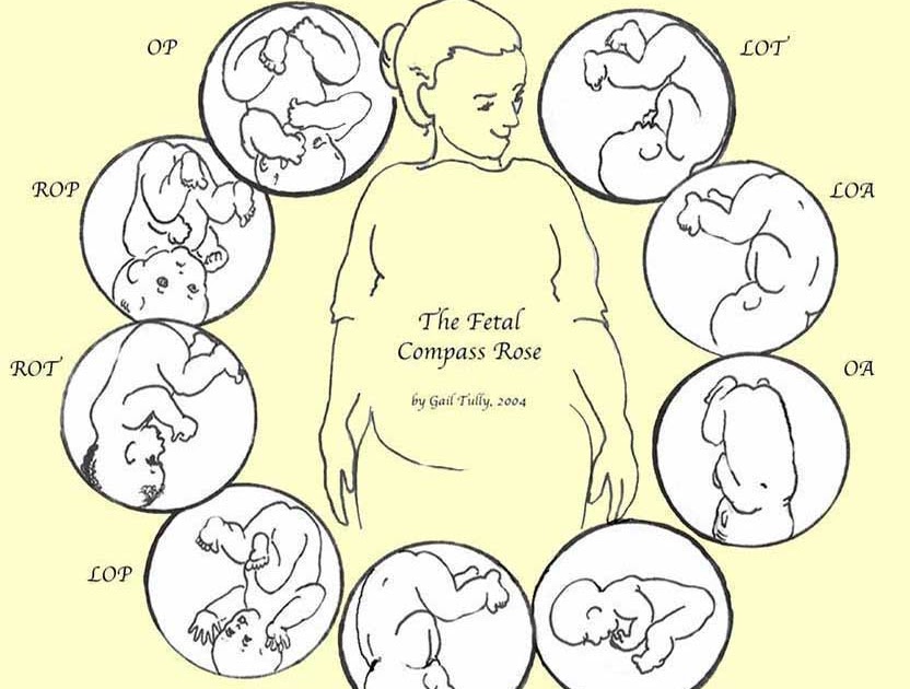 Bun on the Rise Optimal Fetal Positioning Part 1