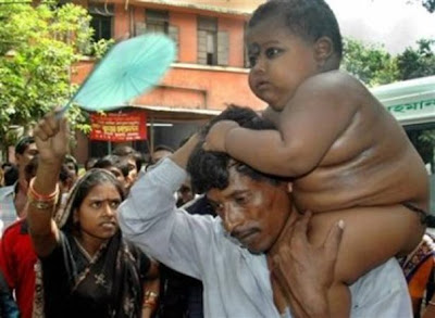 ஷெப்பா World record giant baby (சாதனையா வேதனையா???) Big+Baby
