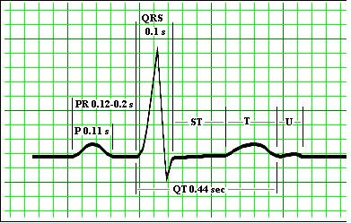 Ecg Qrs