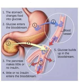 diabetes metabolism