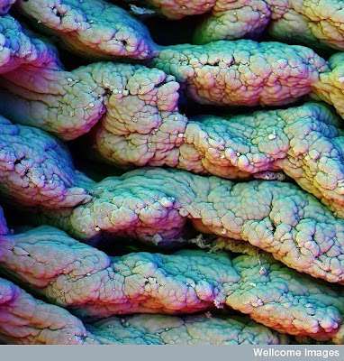 15 imágenes microscópicas del cuerpo humano. 11.+Villi+of+small+intestine.