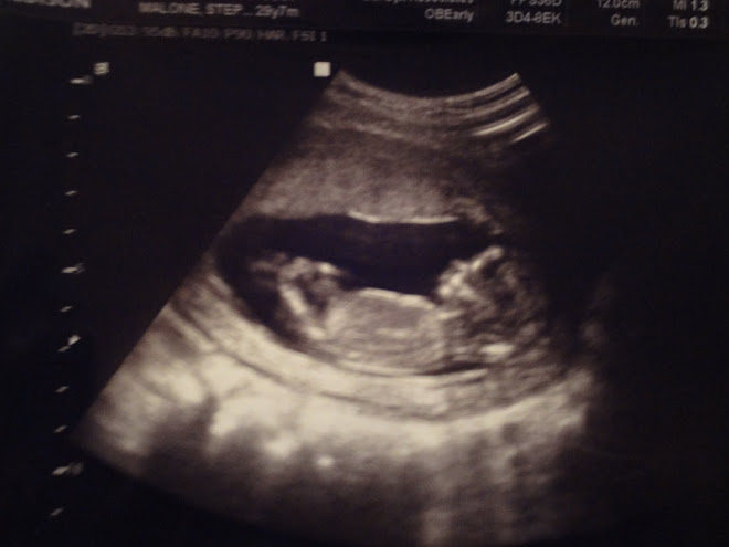 Ultrasound #3