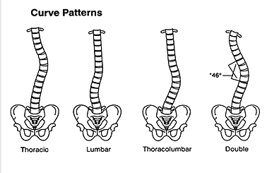 Pelvic Misalignment