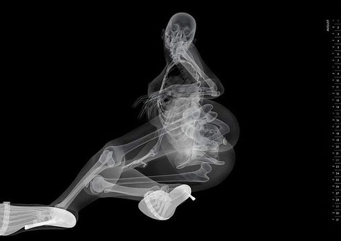 Professora De Mirandela