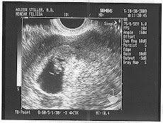 My first Ultrasound Picture!