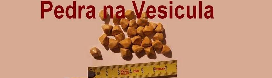 Pedra na Vesicula