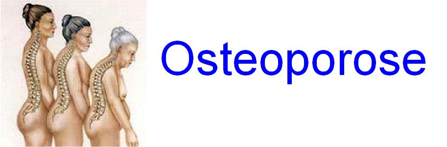 Osteoporose