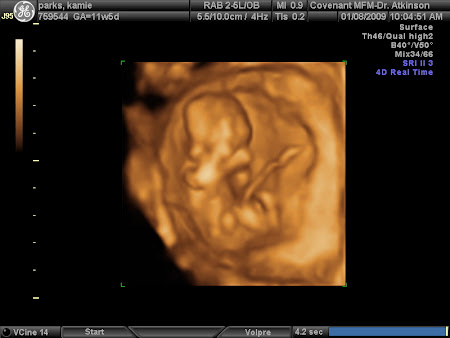Baby in 3d