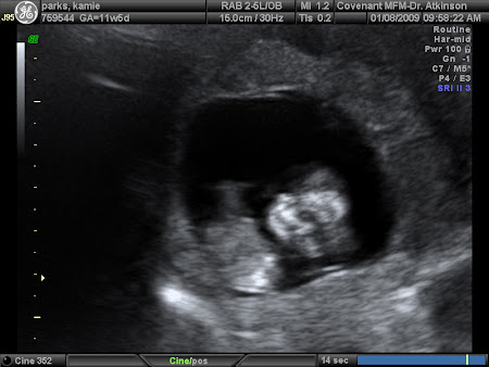 Profile of Baby's Face