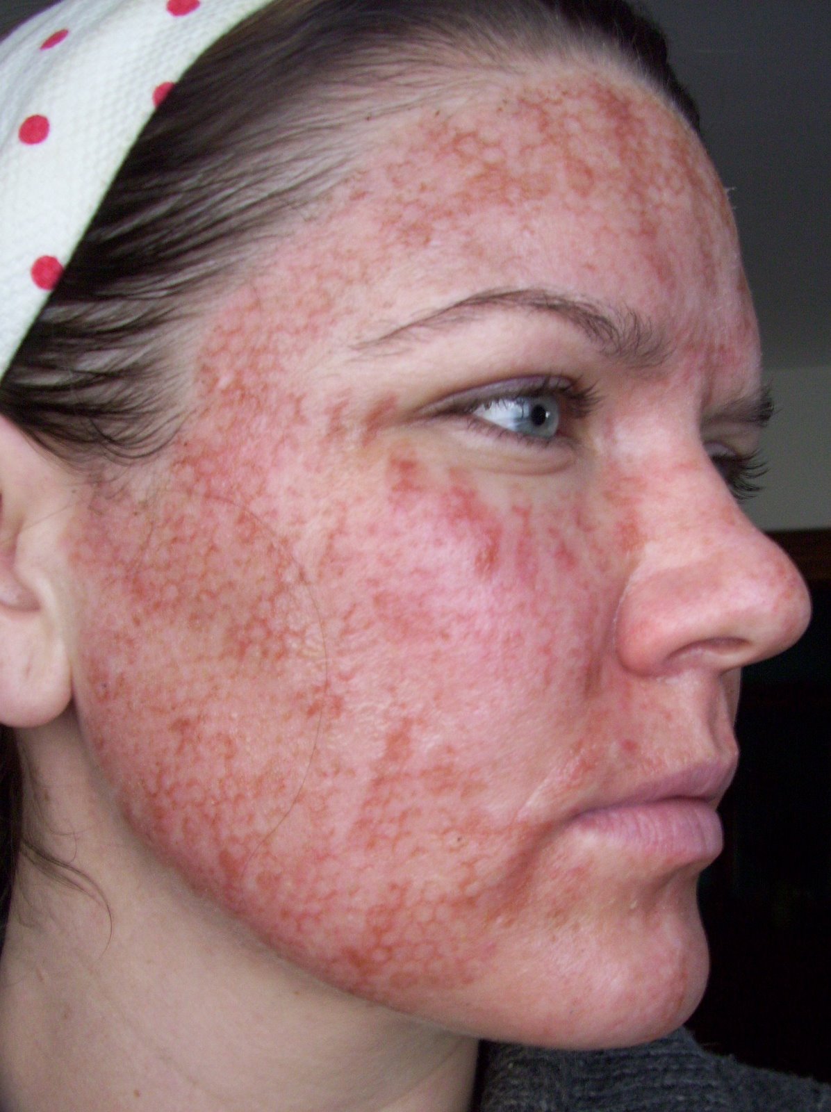 [Post+Pearl+Day+1+Striping.JPG]