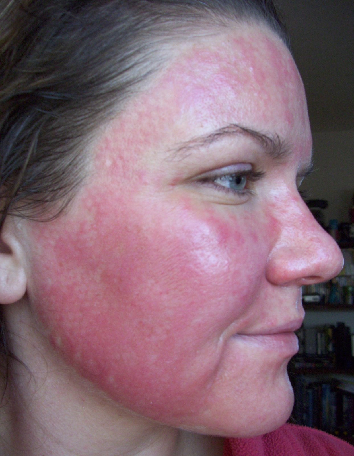 [Post+Pearl+Day+4+Red+Subsiding.JPG]