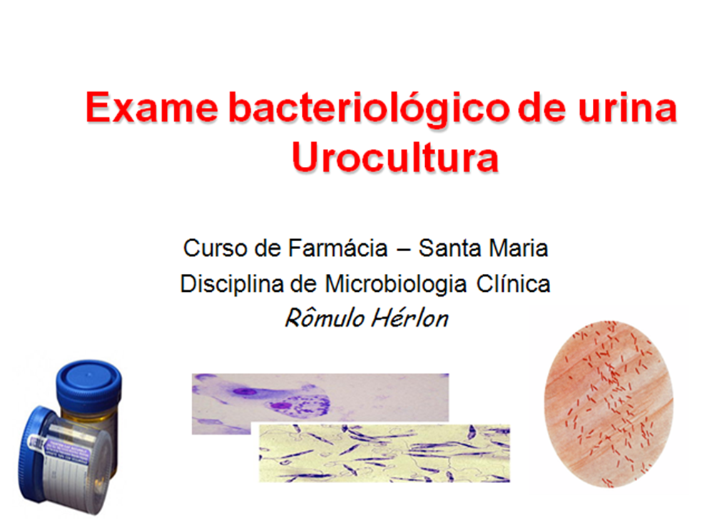 Exame urocultura