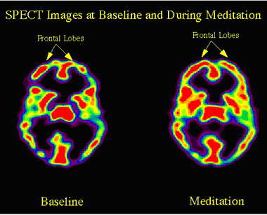 [meditation+brain.jpg]