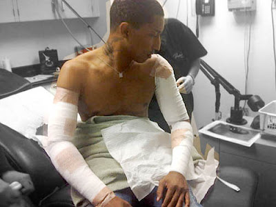 Cloud 10's Think Tank (SOUND OFF) Pharrell's Tattoo Removal! Cloud 10's Think Tank (SOUND OFF) Pharrell's Tattoo Removal!