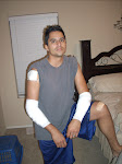 My injured hubby!