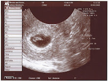 6 week ultrasound