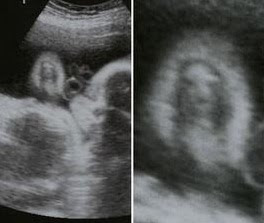 What do you see - Page 2 Ultrasoundimagejesus