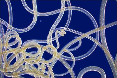 aile genel saglik kadin sagligi yemek tarifleri bagirsak kurtlari