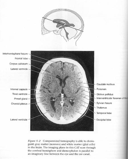Ct+scan+brain+anatomy