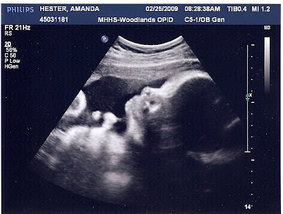 35 week ultrasound
