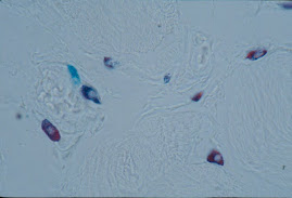Tinción de Mastocitos