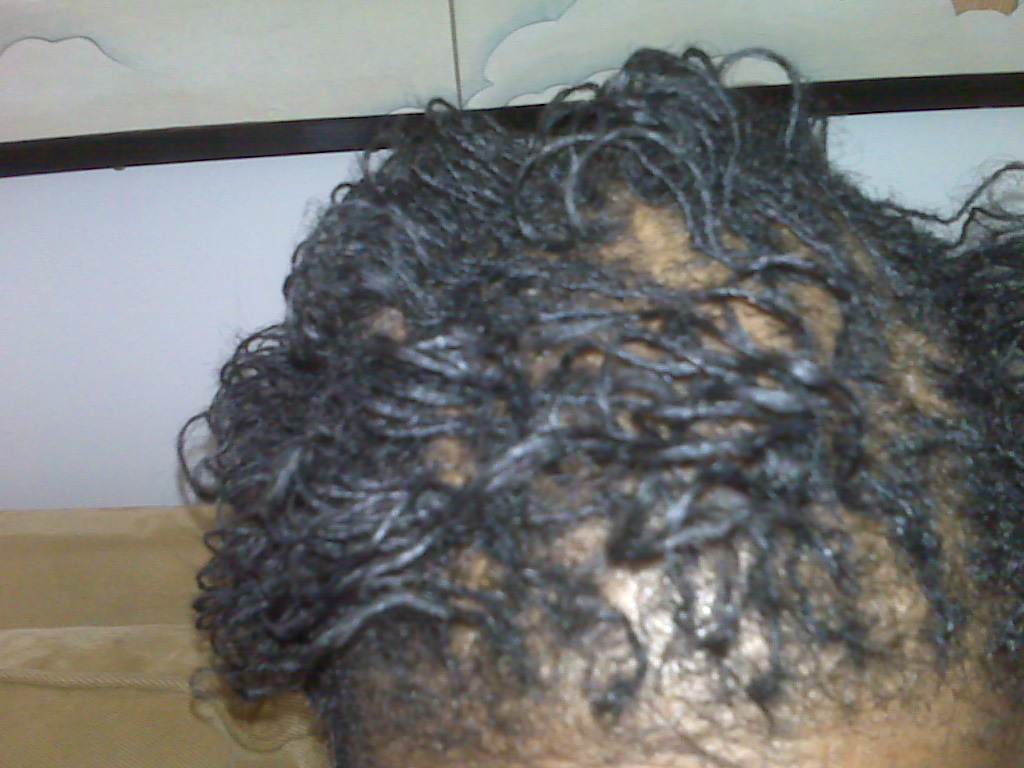 [Rollerset+After.jpg]