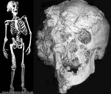 CRITICAS DE PELICULAS Hombre+elefante+esqueleto