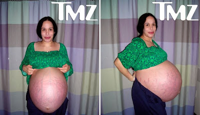 octomom belly