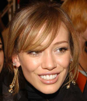 Hilary Duff Veneers