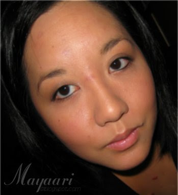Milia Chin