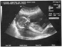 Sonogram 17 weeks 8/9/2007