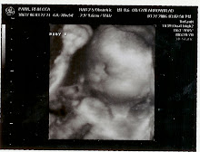 3-D Ultrasound 6 months along