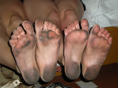 dirty feet