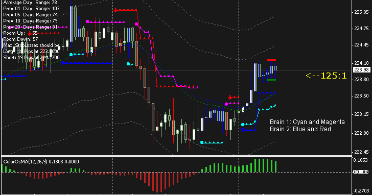 Brain trading system review