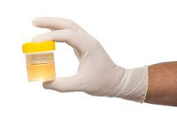 more concentrated urine,
