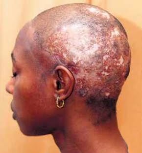Mena Ukodoisready Before You Use That Relaxer On Your Afro Hair