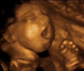 3D ULTRASOUND TESTIMONIALS