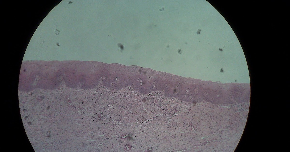 PSC: Anatomy and Physiology 2: Vagina Slide