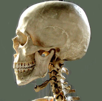 [cranio4a1of.jpg]